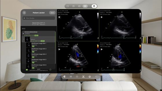 Apple Vision Pro mở ra cơ hội mới cho các nhà phát triển ứng dụng sức khỏe